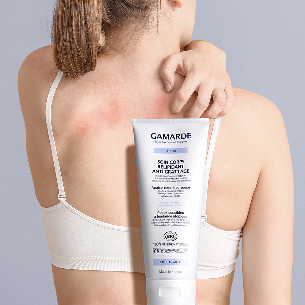 Anti-Scratching Body Care - Επανορθωτική Κρέμα Σώματος Κατά του Κνησμού 200ml - Image 2